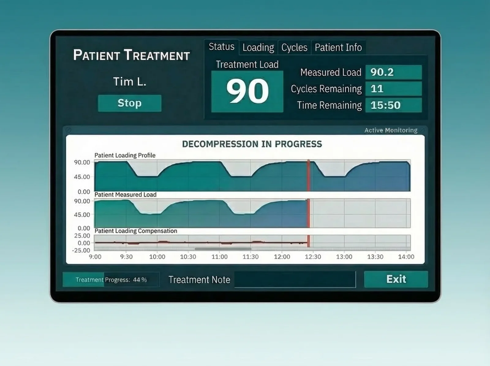 Decompression system monitoring display with force curves